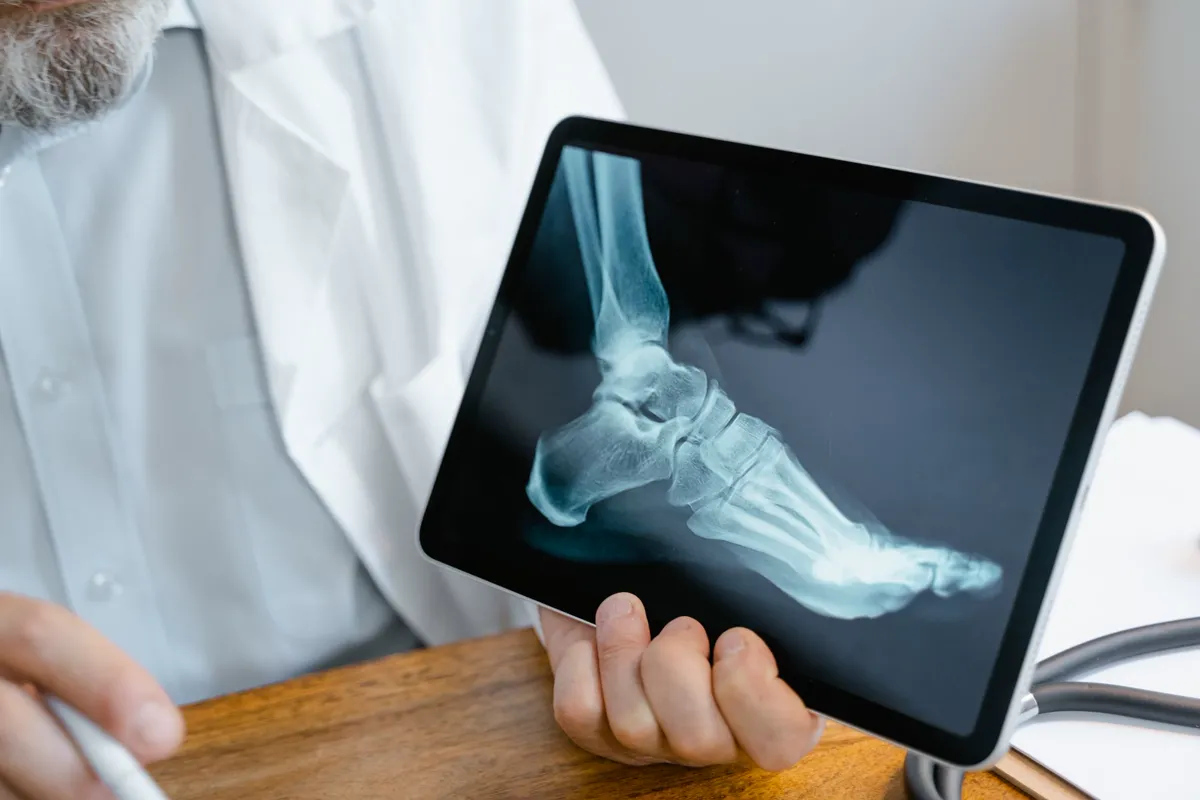 A doctor reading a foot X-ray on a tablet